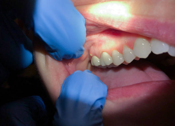 Best Broken Tooth Emergency  in Guerneville, CA